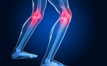 Joint Pain And Treatment Alternatives